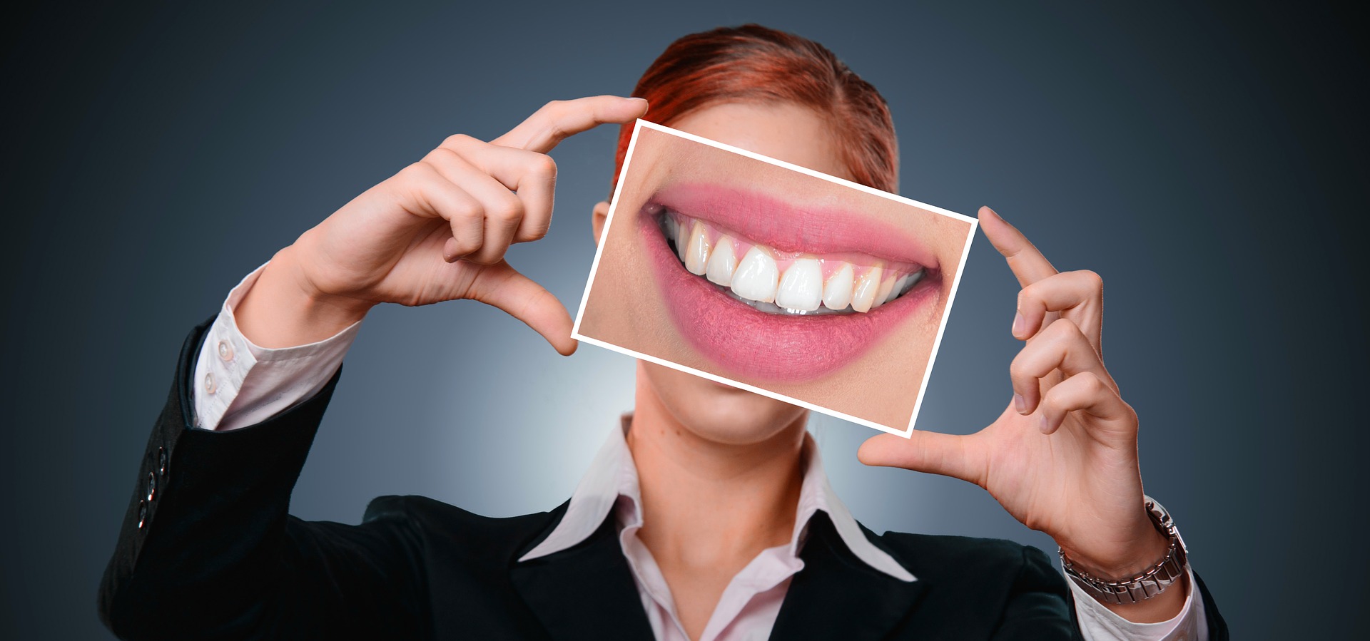Advantages of Dental Implants